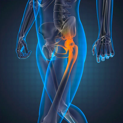 Orthopedic medical application scene — SMI-CA